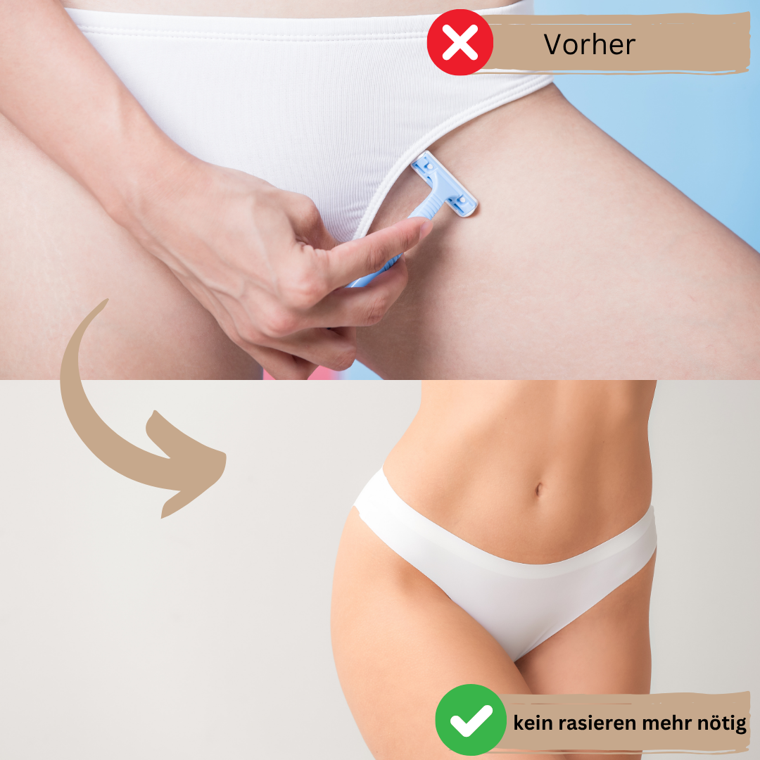GlowSkin - IPL Haarentfernungsgerät - dauerhafte Haarentfernung, schmerzfrei & sicher - für sensible Haut & alle Körperbereiche