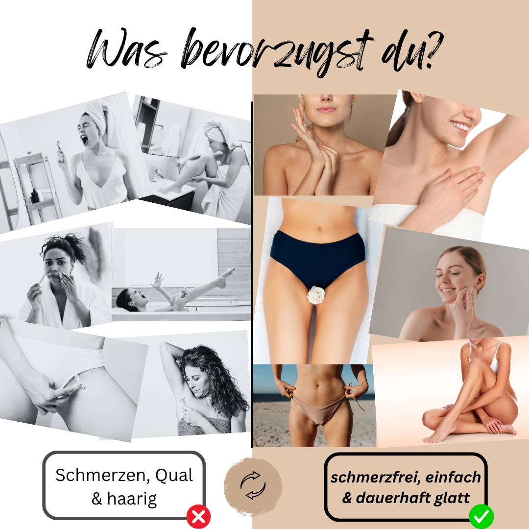 GlowSkin - IPL Haarentfernungsgerät - dauerhafte Haarentfernung, schmerzfrei & sicher - für sensible Haut & alle Körperbereiche