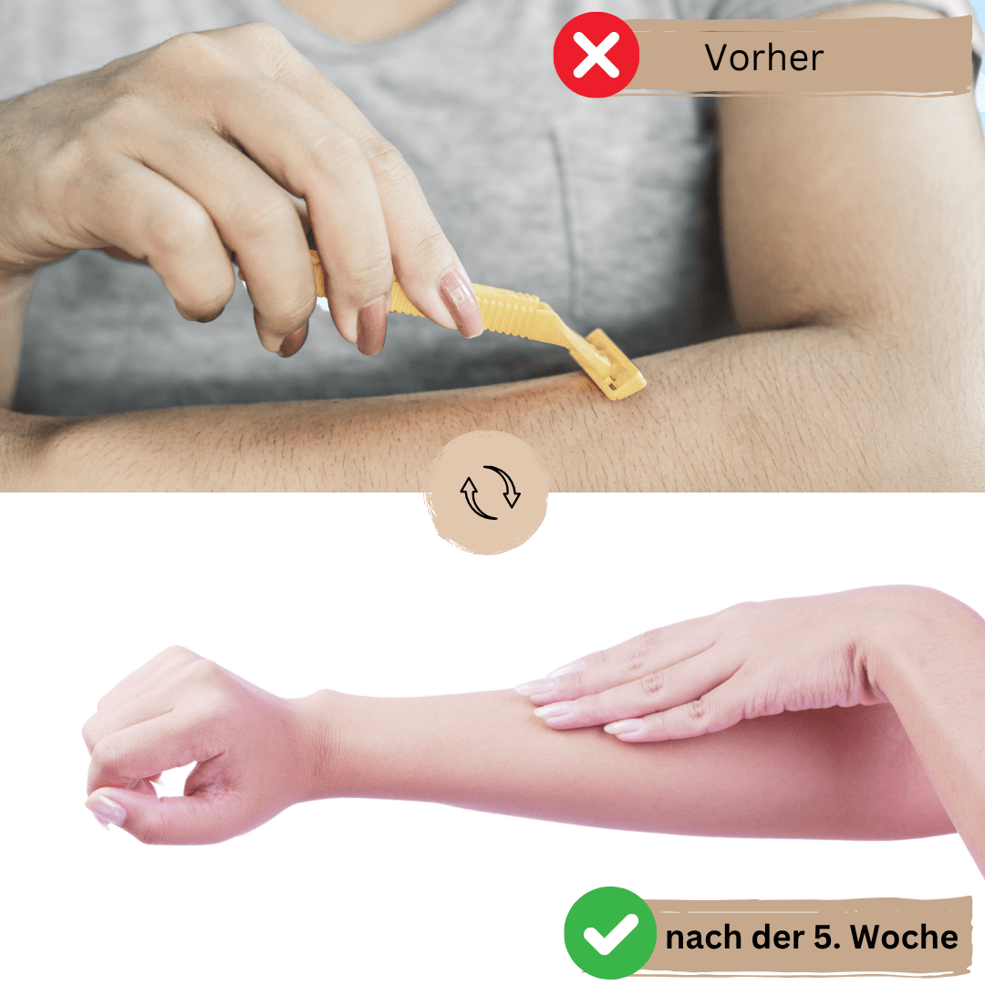 SilkErase - Präzisionsepilierer & Gesichtshaarentferner - schmerzfreie Haarentfernung, ohne Rasurbrand - für glatte & gepflegte Haut - für sensible Haut - Gesicht & Körper - épure paris
