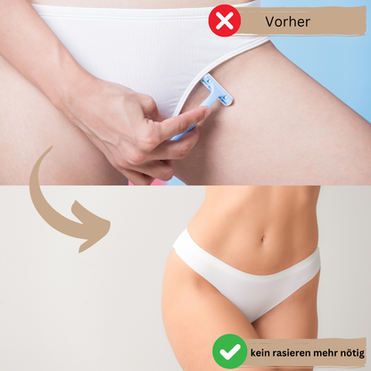 GlowSkin - IPL Haarentfernungsgerät - dauerhafte Haarentfernung, schmerzfrei & sicher - für sensible Haut & alle Körperbereiche
